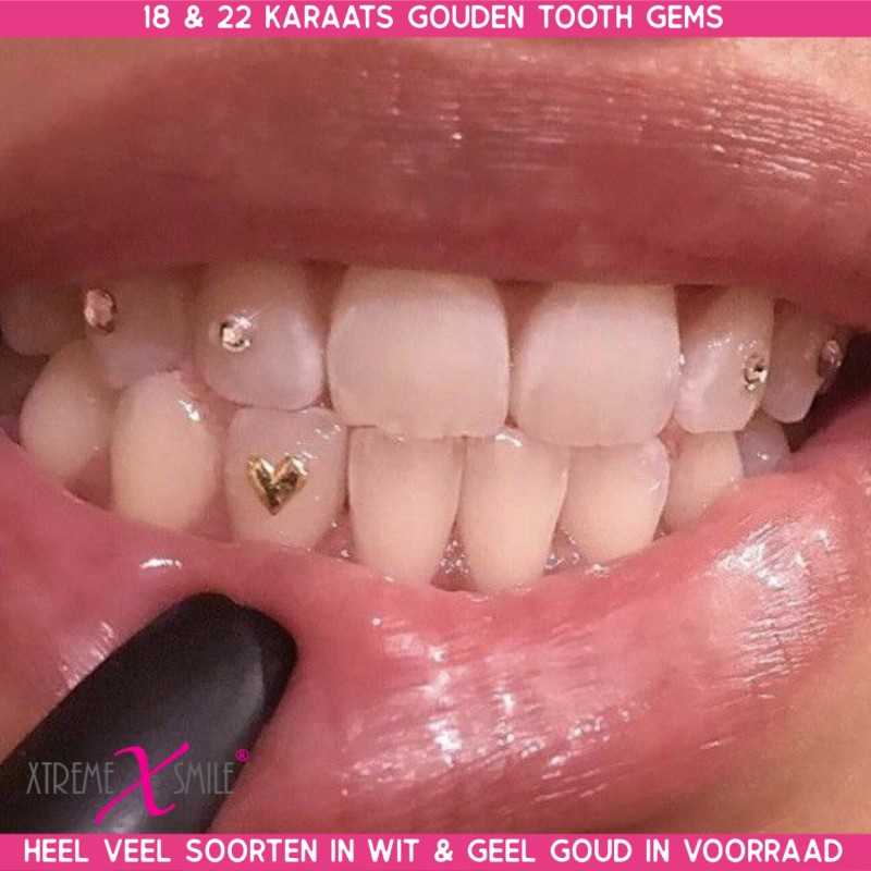 Verdwijnen kanaal Geplooid White Gold Tooth Gem 18ct - Tiny Heart - adds love to your teeth