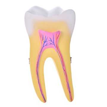 Two-Piece Molar Model –...
