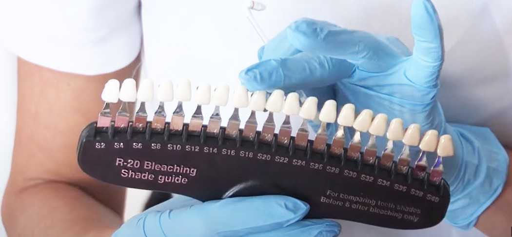 Salon Supplies for teeth whitening salon or clinic