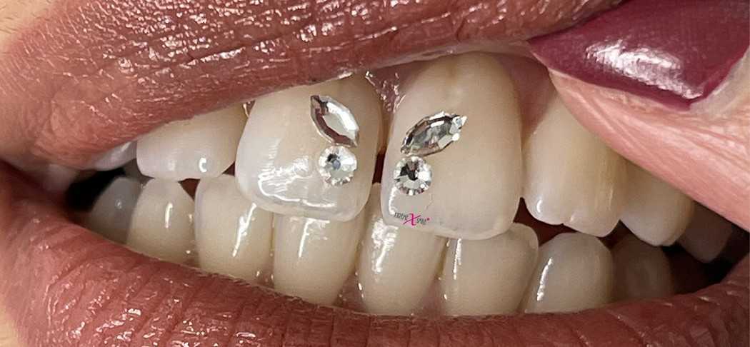 Swarovski Tooth Gem Crystals