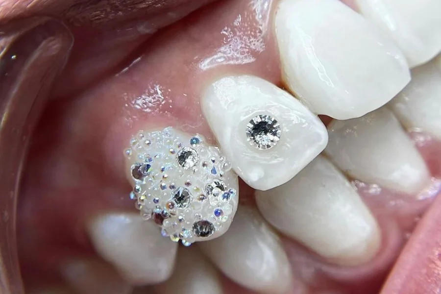 Strass dentaires Swarovski et BLINQ du kit professionnel de démarrage
